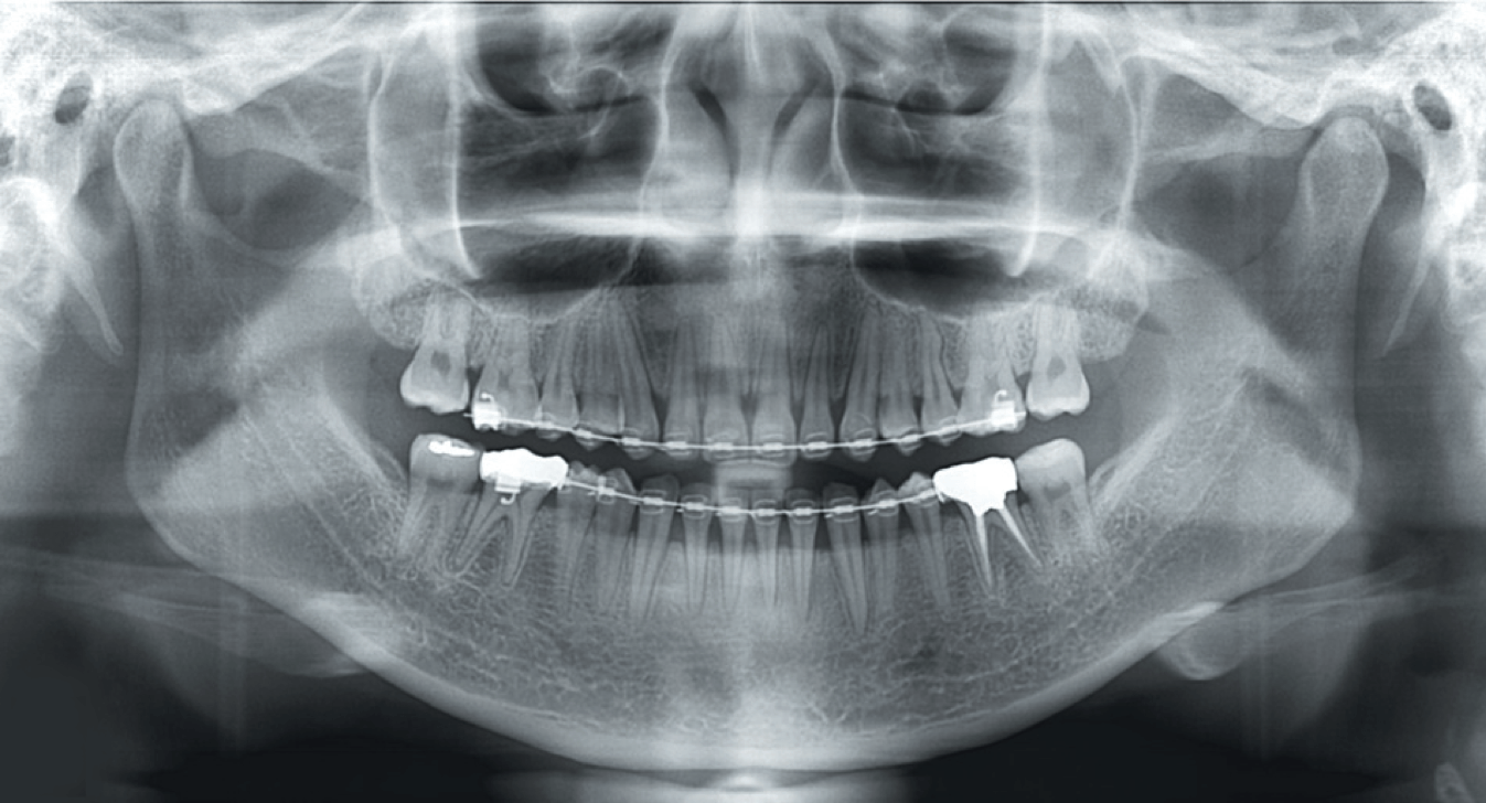 equipment insurance office 3D Computed Broadway Cone Beam  Tomography Family  (CBCT)