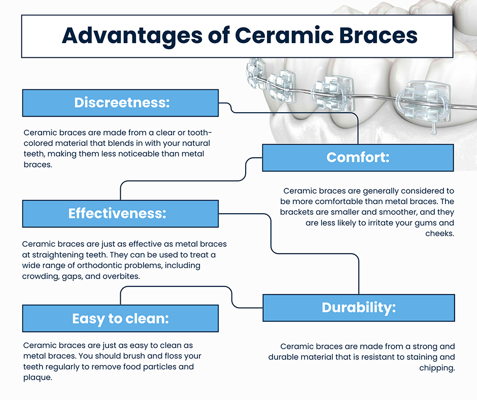 Advantages Of Ceramic Braces To Straighten Your Teeth