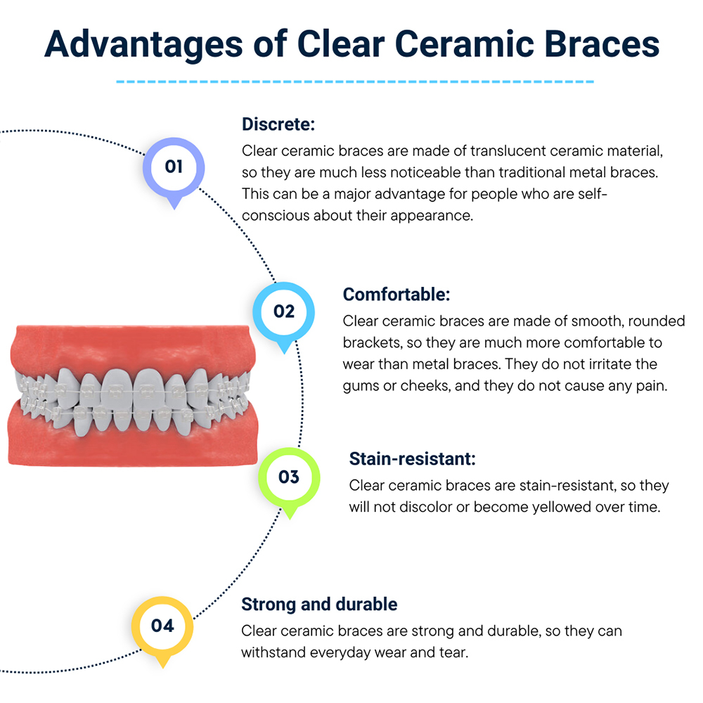 Smile Solutions Dental Anonas - CERAMIC BRACES Also known as clear braces,  are orthodontic tools used to straighten teeth and fix bite problems. They  consist of clear or tooth-colored ceramic brackets attached