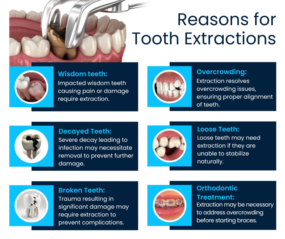 Reasons for Tooth Extractions
