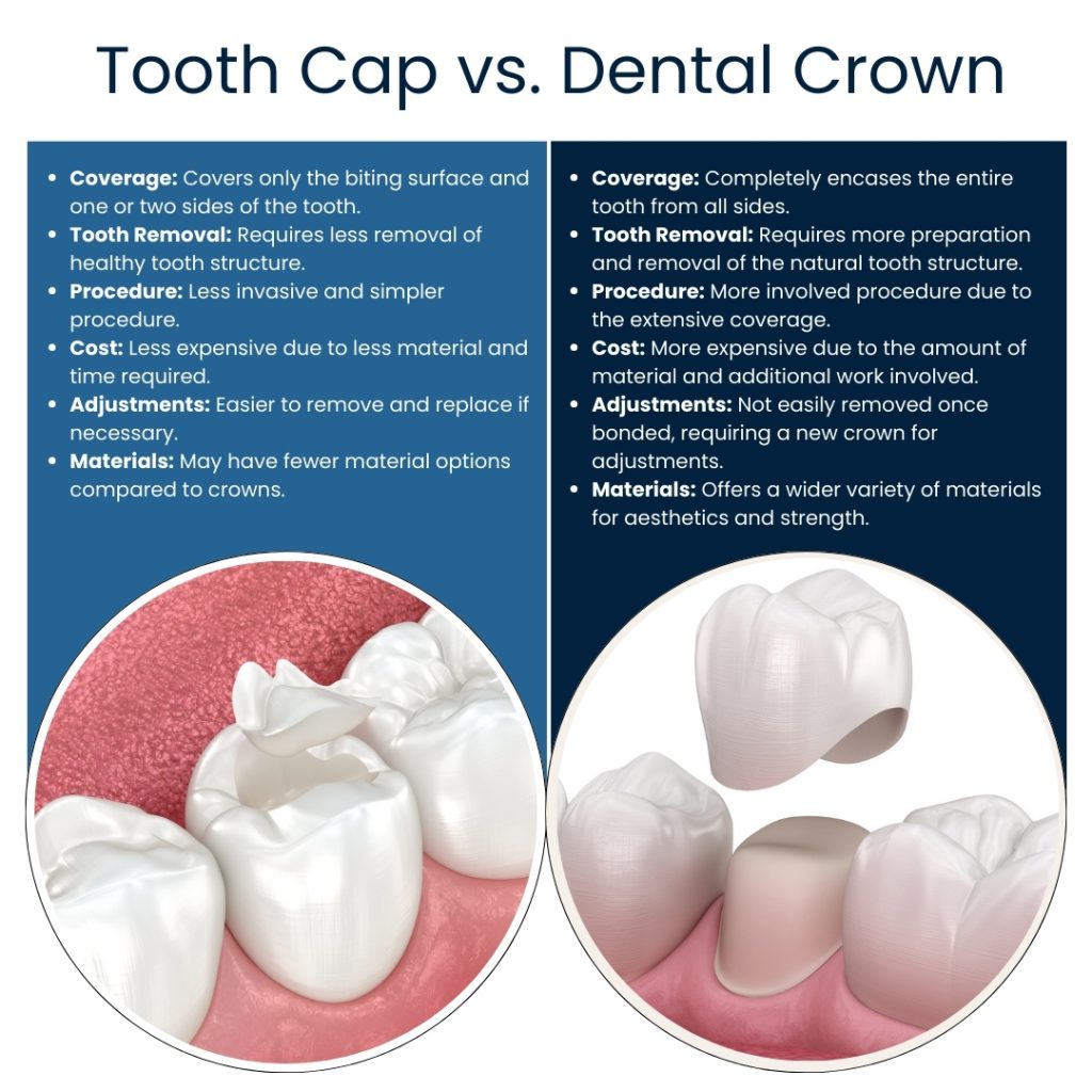 Difference Between A Cap And A Crown | Broadway Family Dental